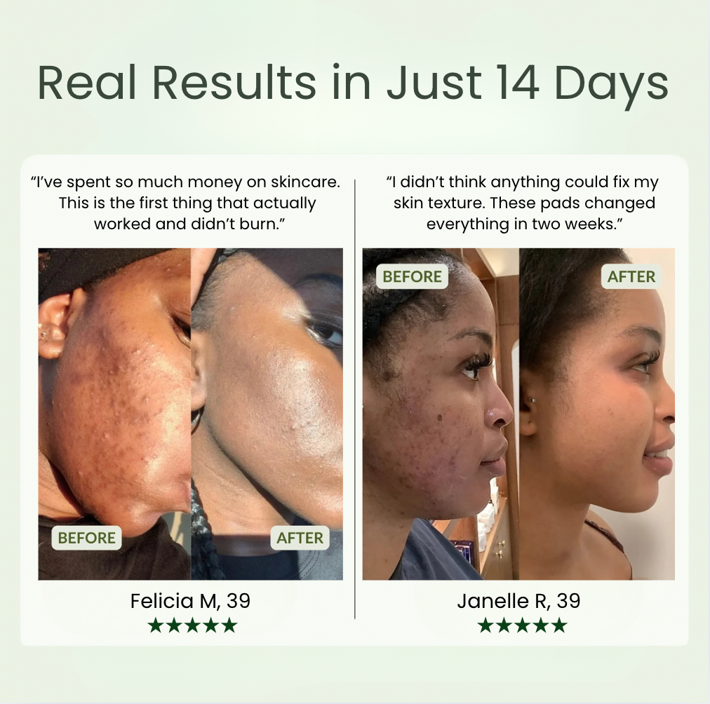 Tone + Glow Complex™ Pads
